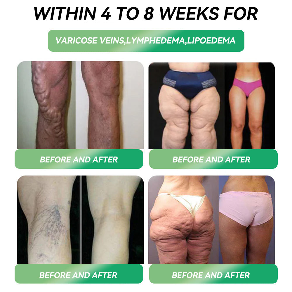 LOVILDS™ Tirzepatide Slimming & health NANO MICRONEEDLE PATCH 👩⚕️Suitable for obesity, cardiovascular diseases, diabetes, sleep apnea, high cholesterol and blood lipids, joint problems, and various other conditions
