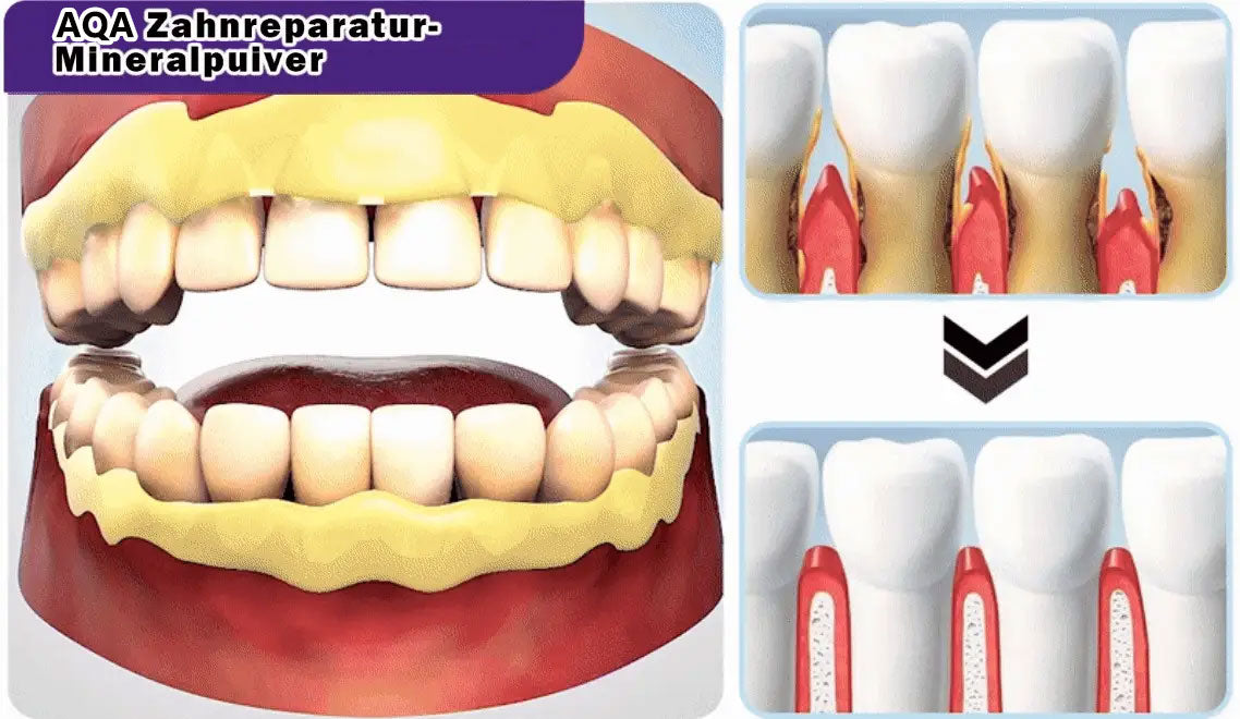 AQA™ Teeth Restoration Powder – Dentist-Approved Enamel Repair (CDA Certified) 🦷 | Flash Sale Today Only!