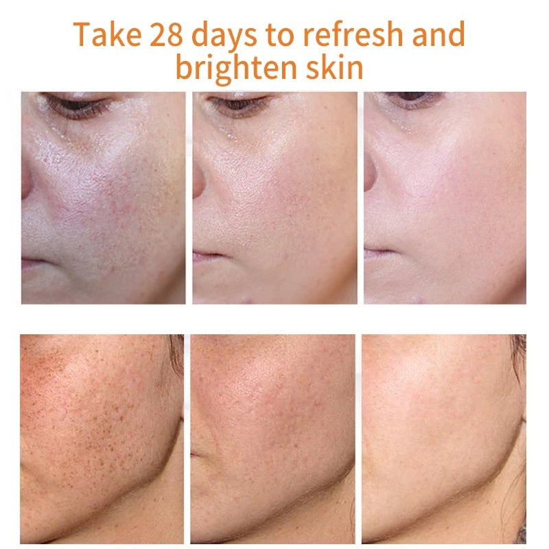 TAILEDEN® Blemish Cream – Fade Age Spots, Freckles & Wrinkles | Youthful, Radiant Skin