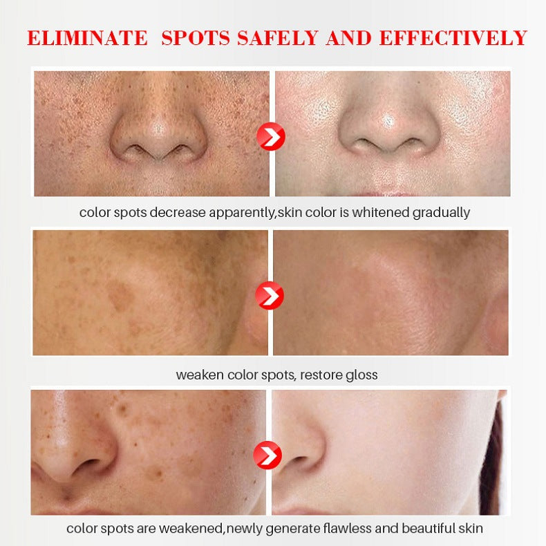 TAILEDEN® Blemish Cream – Fade Age Spots, Freckles & Wrinkles | Youthful, Radiant Skin