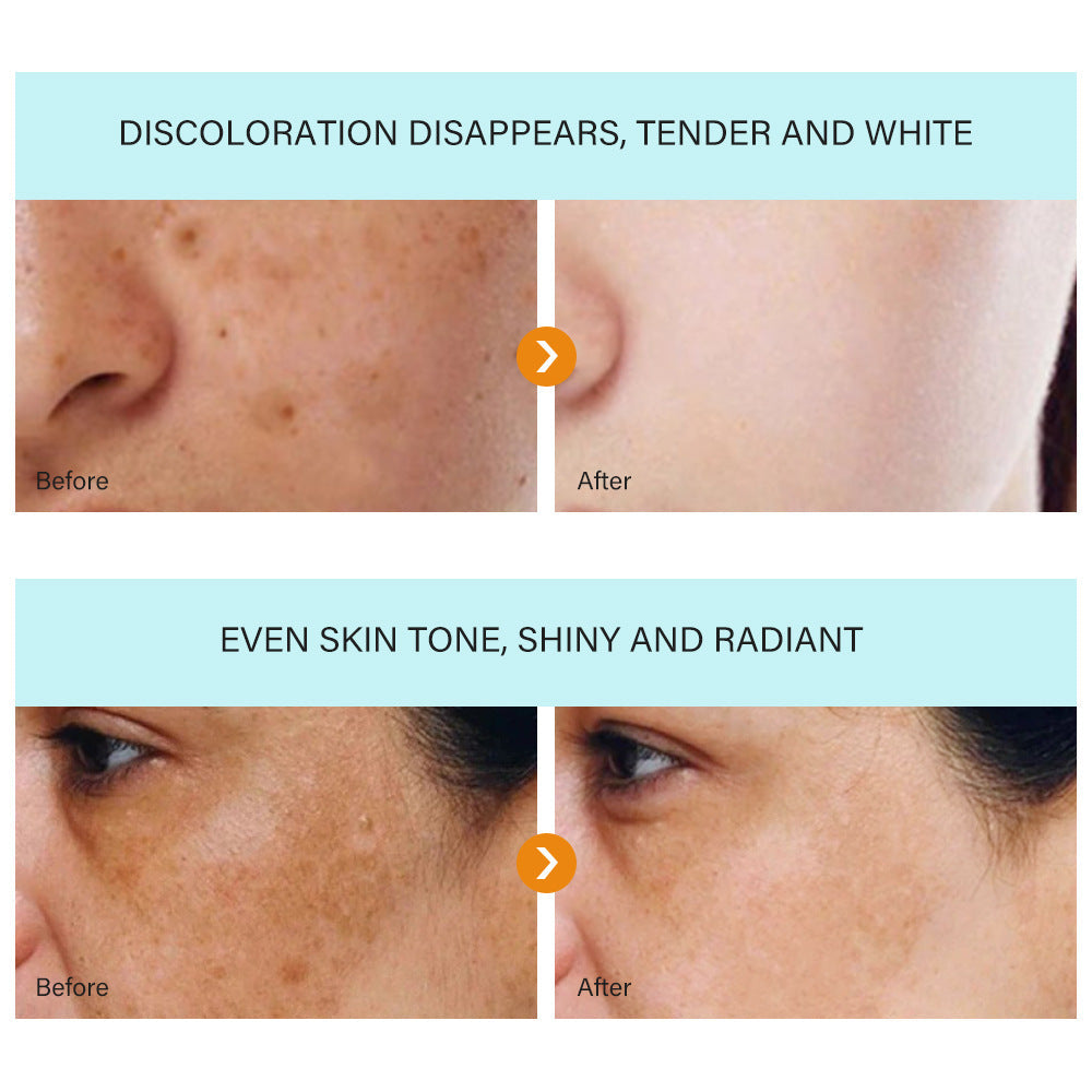 TAILEDEN® Blemish Cream – Fade Age Spots, Freckles & Wrinkles | Youthful, Radiant Skin