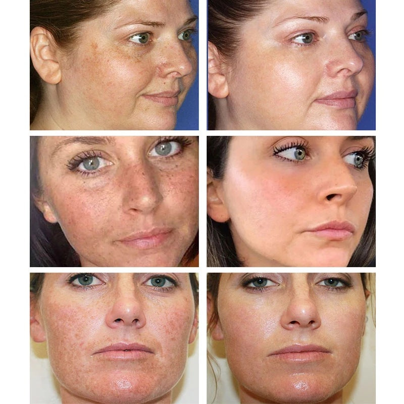 TAILEDEN® Blemish Cream – Fade Age Spots, Freckles & Wrinkles | Youthful, Radiant Skin