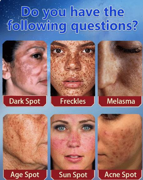 TAILEDEN® Blemish Cream – Fade Age Spots, Freckles & Wrinkles | Youthful, Radiant Skin