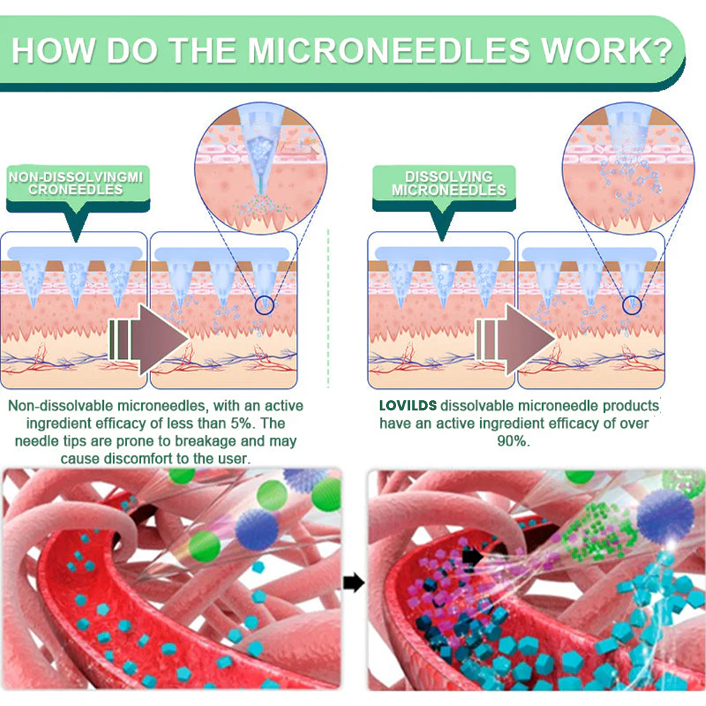 LOVILDS™ Tirzepatide Slimming & health NANO MICRONEEDLE PATCH 👩⚕️Suitable for obesity, cardiovascular diseases, diabetes, sleep apnea, high cholesterol and blood lipids, joint problems, and various other conditions