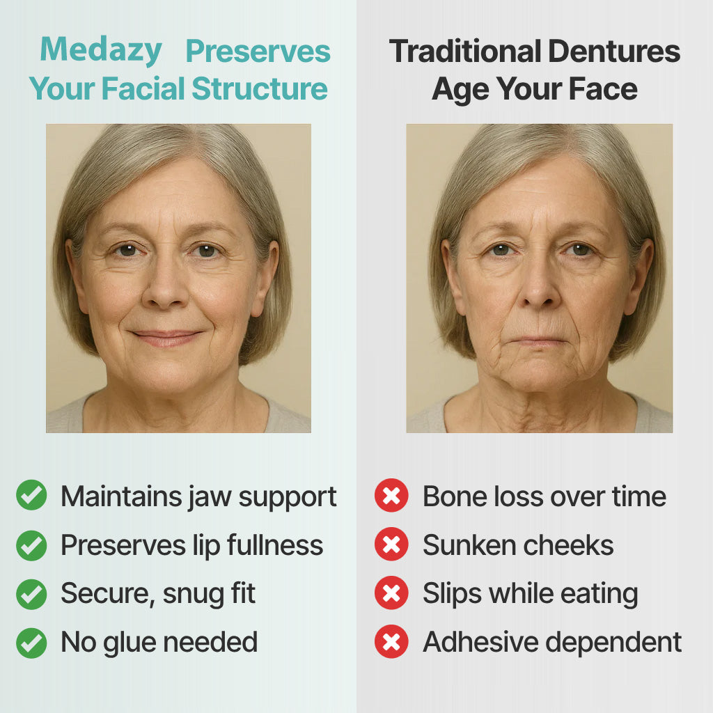 Medazy™ Custom-Fit Full Functional Dentures-f