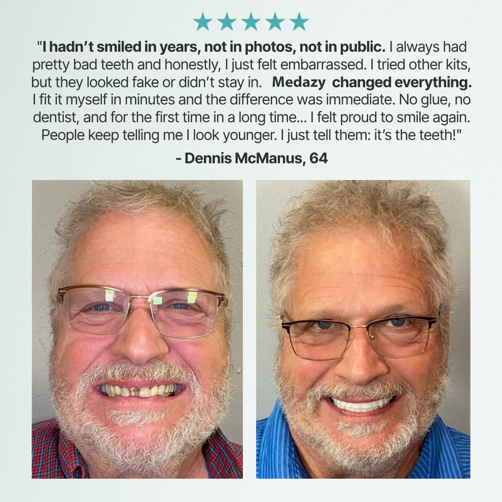 Medazy™ Custom-Fit Full Functional Dentures-f