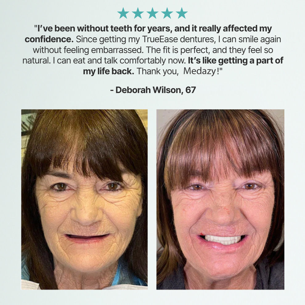 Medazy™ Custom-Fit Full Functional Dentures-f
