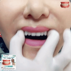 （Official dentures）Medazy™ Custom-Fit Full Functional Dentures