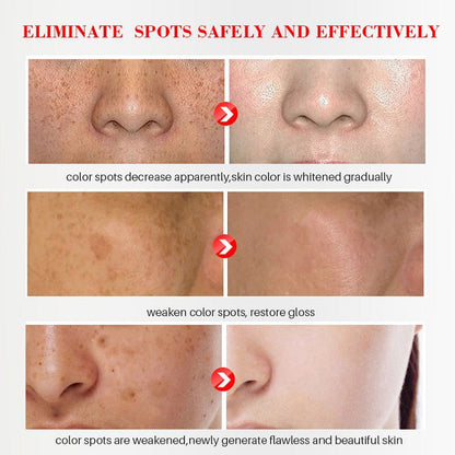 TAILEDEN® Blemish Cream – Fade Age Spots, Freckles & Wrinkles | Youthful, Radiant Skin