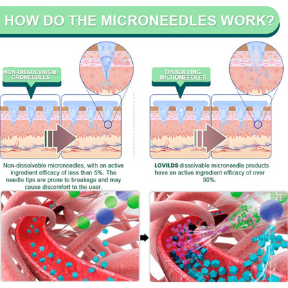 LOVILDS™  Tirzepatide Slimming & health NANO MICRONEEDLE PATCH 👩‍⚕️Suitable for obesity, cardiovascular diseases, diabetes, sleep apnea, high cholesterol and blood lipids, joint problems, and various other conditions