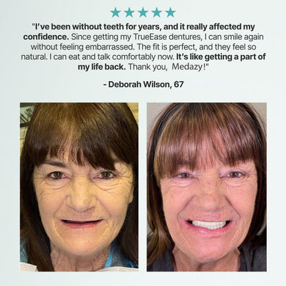 Medazy™ Custom-Fit Full Functional Dentures-f